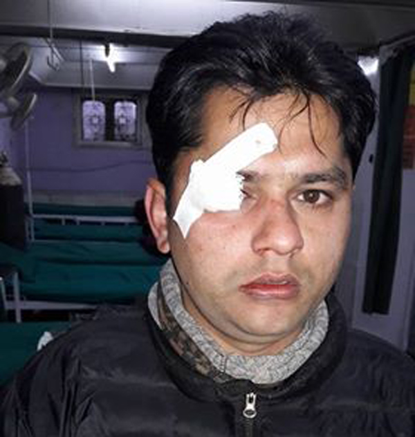 ANNFSU leader Gautam injured in clash with ANNISU